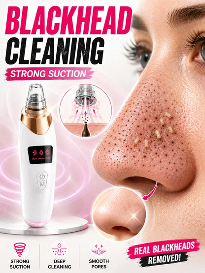 Electric Blackhead Remover & Pore Cleaner – Facial Vacuum Skin Cleaning Device for Blackheads, Pimples & Acne, Portable Pore Care Tool