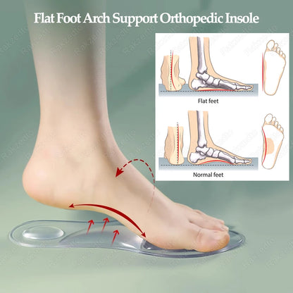 Medical Silicone Orthopedic Insoles for Women – Gel Arch Support Shoe Inserts for Flat Feet, Plantar Foot Comfort & Cushioning