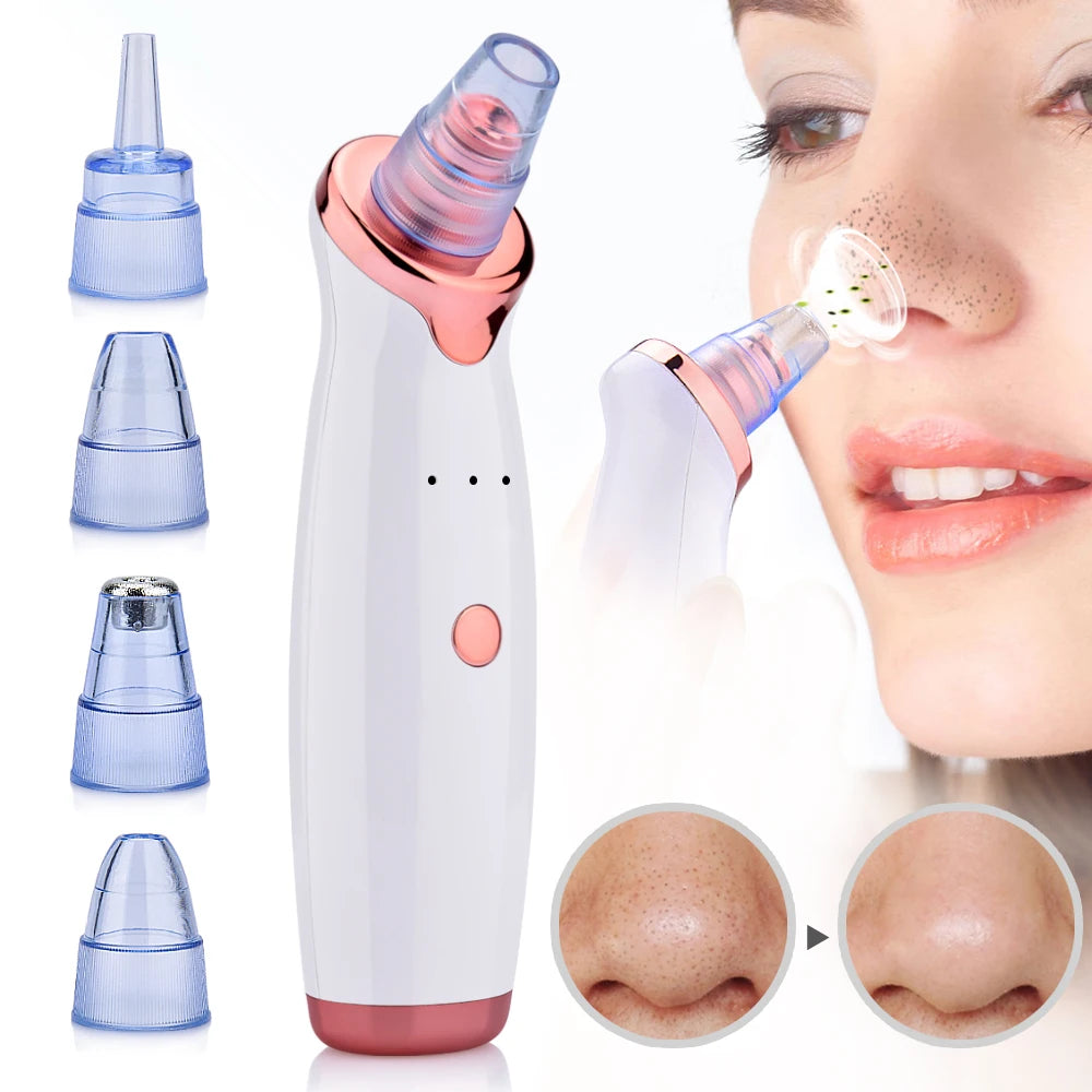 Electric Blackhead Remover & Pore Cleaner – Facial Vacuum Suction Tool for Blackheads, Acne & Pore Care, Portable Skin Cleaning Device