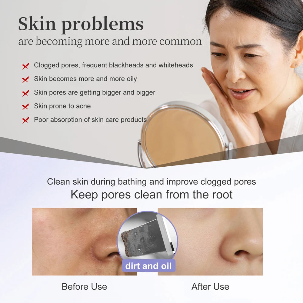ANLAN Limpiador Facial Ultrasónico – Limpiador de Poros Profundo con Peeling Ultrasónico, Dispositivo LED Rojo y Azul para Lifting Facial (Resistente al Agua IPX7)