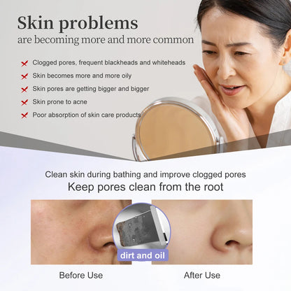 ANLAN Limpiador Facial Ultrasónico – Limpiador de Poros Profundo con Peeling Ultrasónico, Dispositivo LED Rojo y Azul para Lifting Facial (Resistente al Agua IPX7)