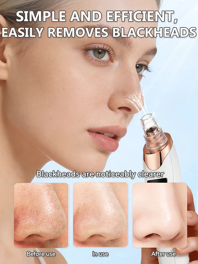 Electric Blackhead Remover & Pore Cleaner – Facial Vacuum Skin Cleaning Device for Blackheads, Pimples & Acne, Portable Pore Care Tool