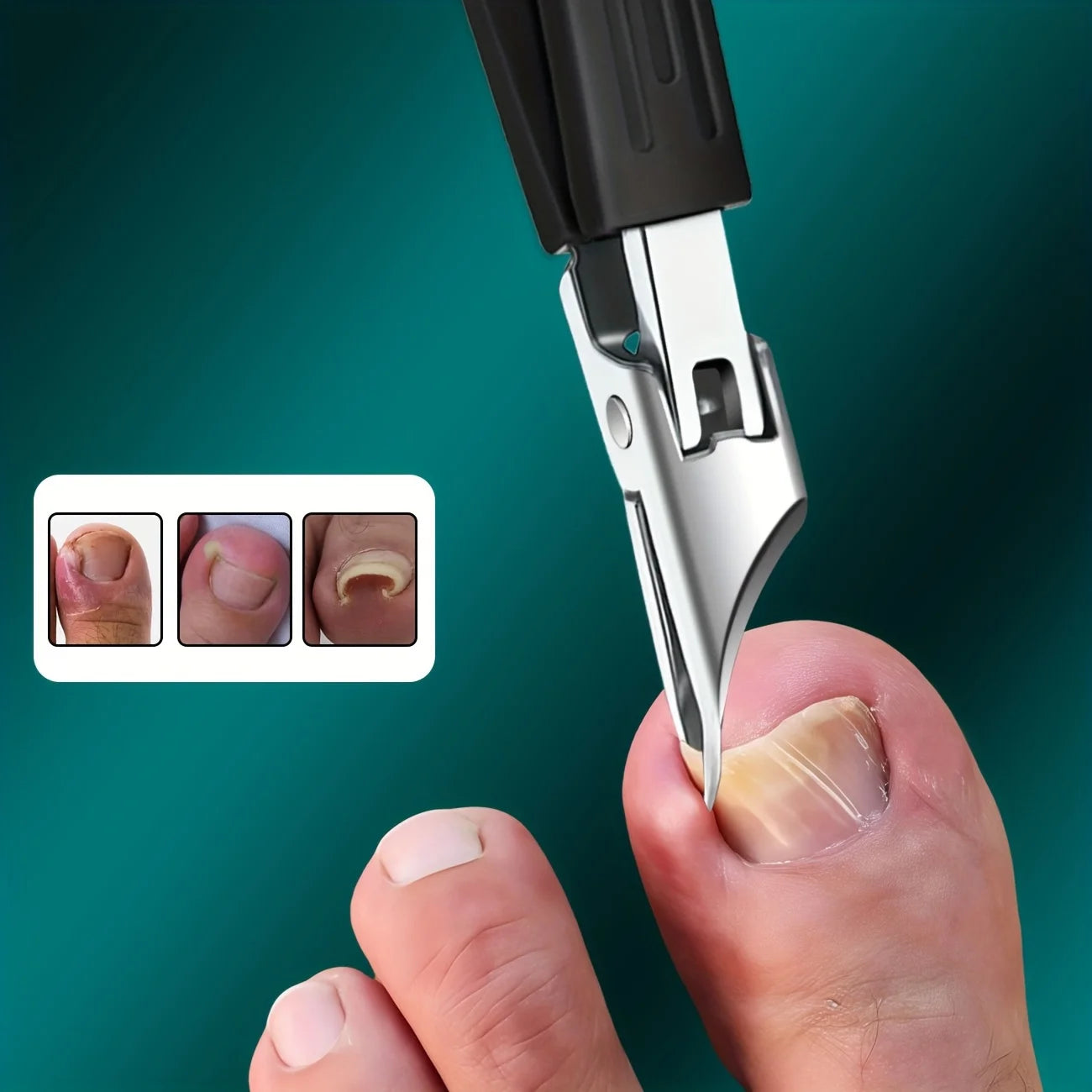 Coupe-ongles incarnés robuste en acier inoxydable – Lame ultra-tranchante inclinée à 25° avec poignée souple pour ongles épais