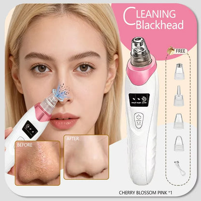 Electric Blackhead Remover & Pore Cleaner – Facial Vacuum Skin Cleaning Device for Blackheads, Pimples & Acne, Portable Pore Care Tool