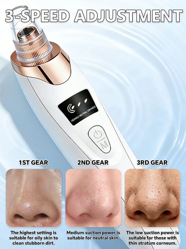 Electric Blackhead Remover & Pore Cleaner – Facial Vacuum Skin Cleaning Device for Blackheads, Pimples & Acne, Portable Pore Care Tool