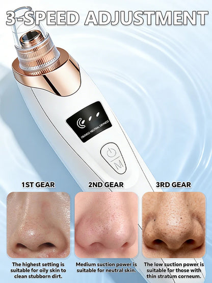 Electric Blackhead Remover & Pore Cleaner – Facial Vacuum Skin Cleaning Device for Blackheads, Pimples & Acne, Portable Pore Care Tool
