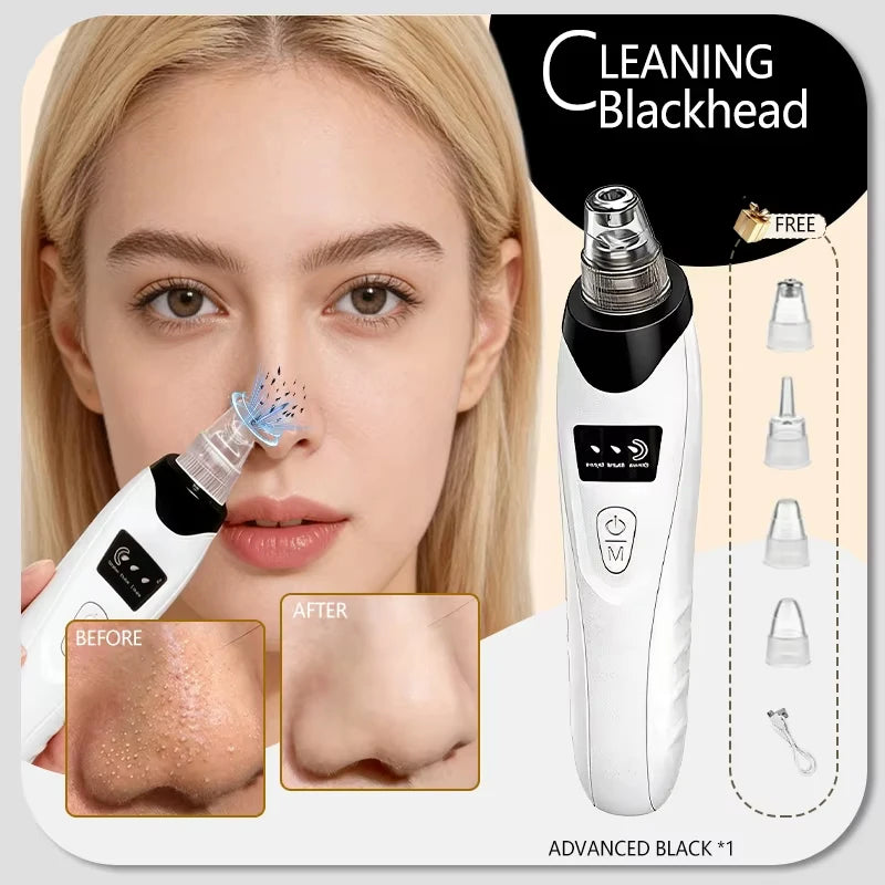 Electric Blackhead Remover & Pore Cleaner – Facial Vacuum Skin Cleaning Device for Blackheads, Pimples & Acne, Portable Pore Care Tool